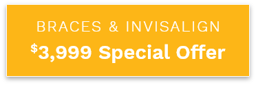 $3999 Off Orthodontics special