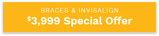 $3999 Off Orthodontics special